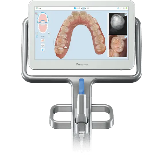 iTero Digital Scanner